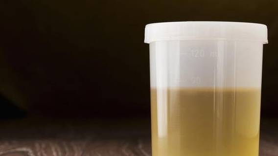 症状|肾友总纠结病情是否好转?3个方面都符合,恭喜你远离肾衰竭