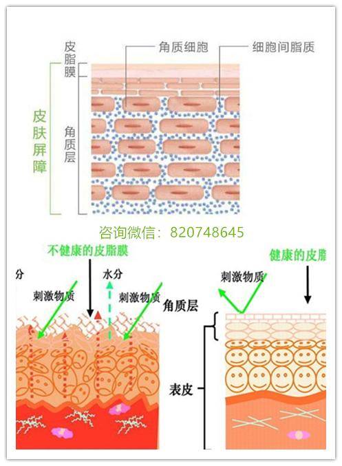 什么换季出现各种各样的皮肤问题，要考虑一下是不是皮肤屏障受损？