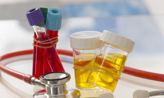 蛋白尿|尿常规结果波动比较大，我们怎样确定自己是否存在蛋白尿？