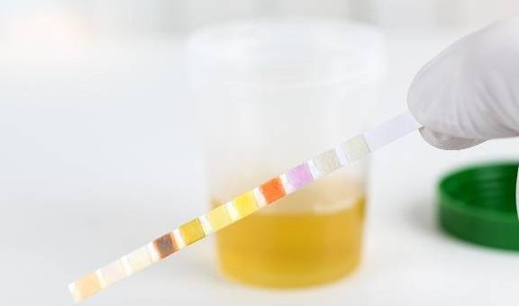 症状|肝不舒服的人,会有3处变黄、2处变臭,若你全没中,肝还算健康!