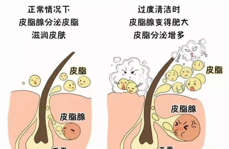 梳子为什么你的头发越洗越油？