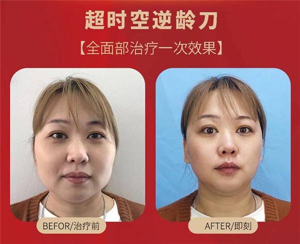 治疗抗“垮”神器：最近朋友圈火爆的超时空逆龄刀