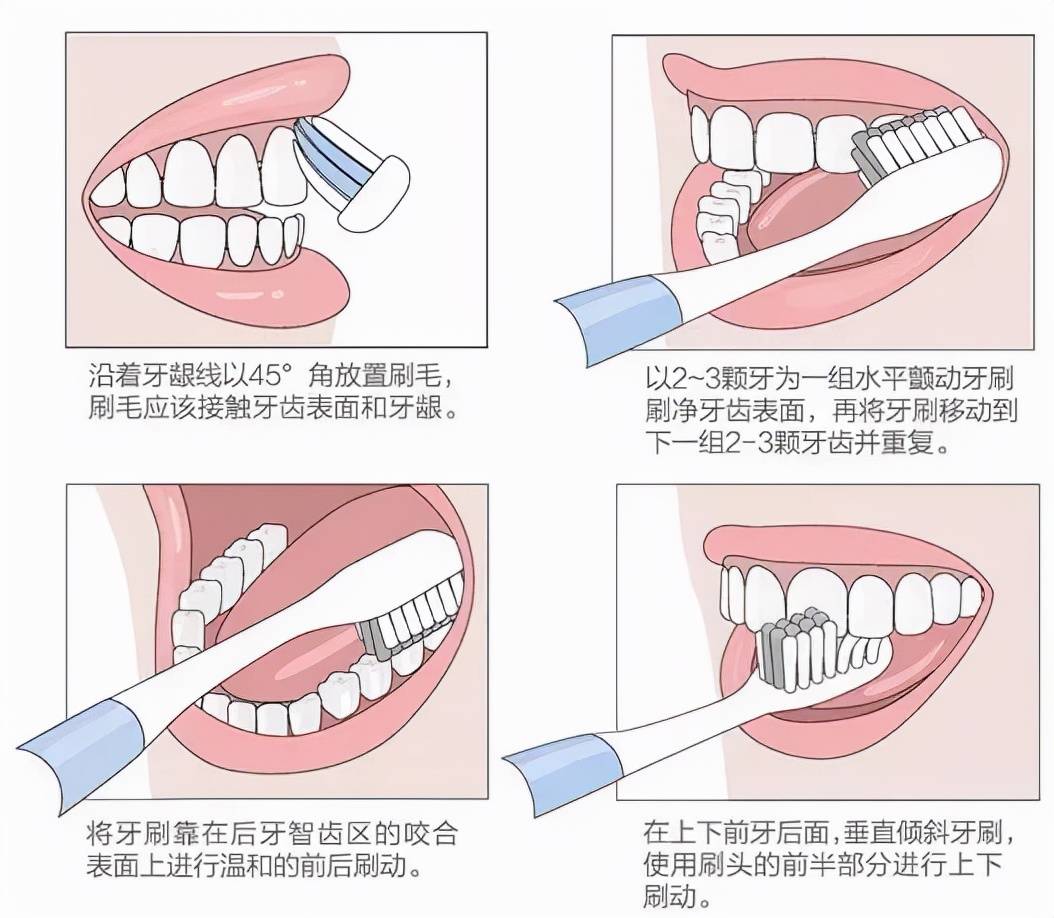 45度角刷牙示意图图片