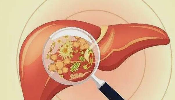 肝脏|从肝病的角度看，右上腹疼痛一般是什么原因？应该如何应对？