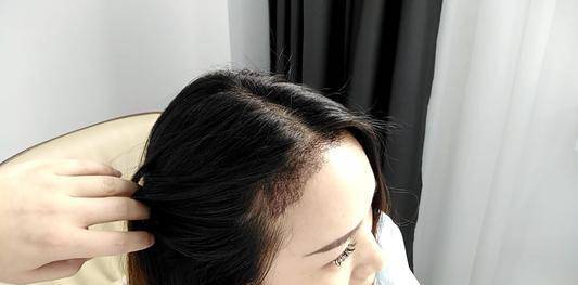 护发女人再忙，早上洗完脸后，3个地方也要记得保养，或能缓解衰老