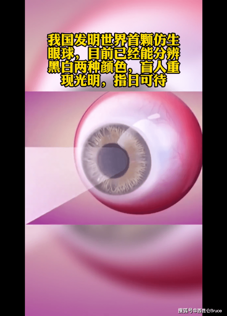 盲人或可重见光明 我国发明世界首颗仿生眼球 目前可分辨黑白 视网膜