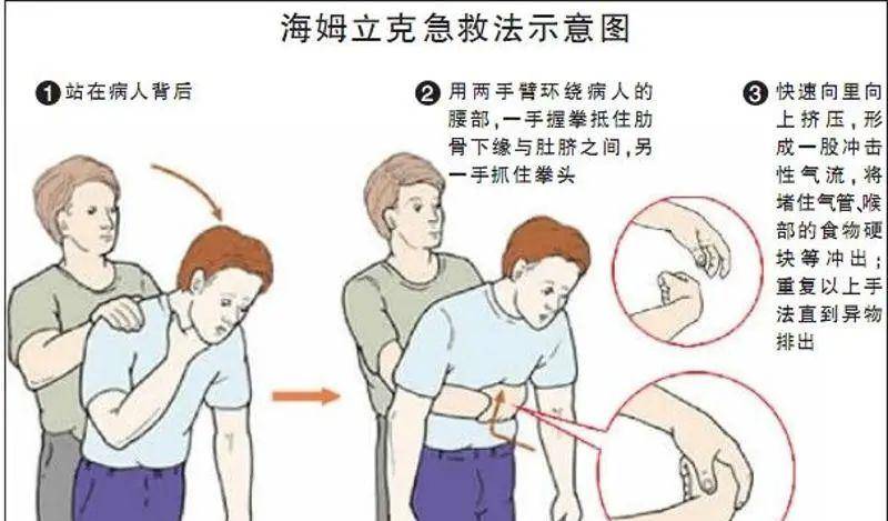 带着|九旬阿婆吃药被卡，竟从胃里掏出了带着完整铝箔外包装的药片