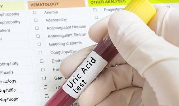 类人|“尿毒症”比较喜欢这3类人，若你也位列其中，或许该“忌口”了