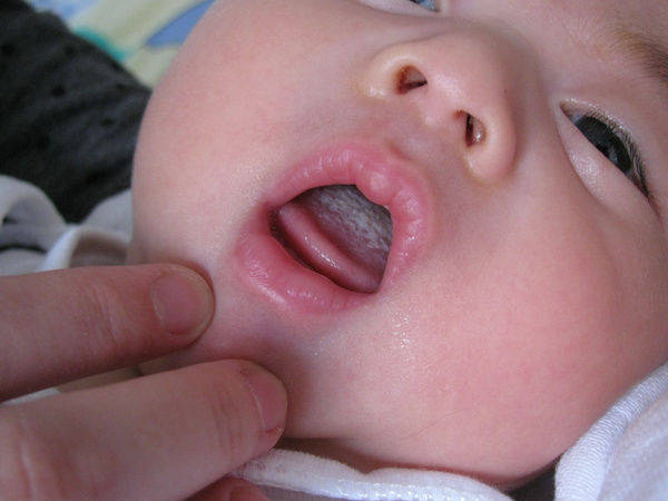 家长|孩子积食长个难,容不得家长大意,这4个原因家长一定要清楚