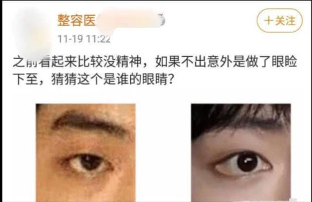 整形整形医生谈娱乐圈整容风气：王一博肖战天生丽质，部分女星为了变美心狠手辣