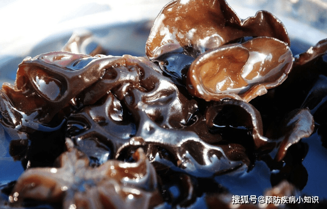 肝脏|肝癌多是吃出来的？大夫建议：这1道菜经常吃，肝或会被“击垮”