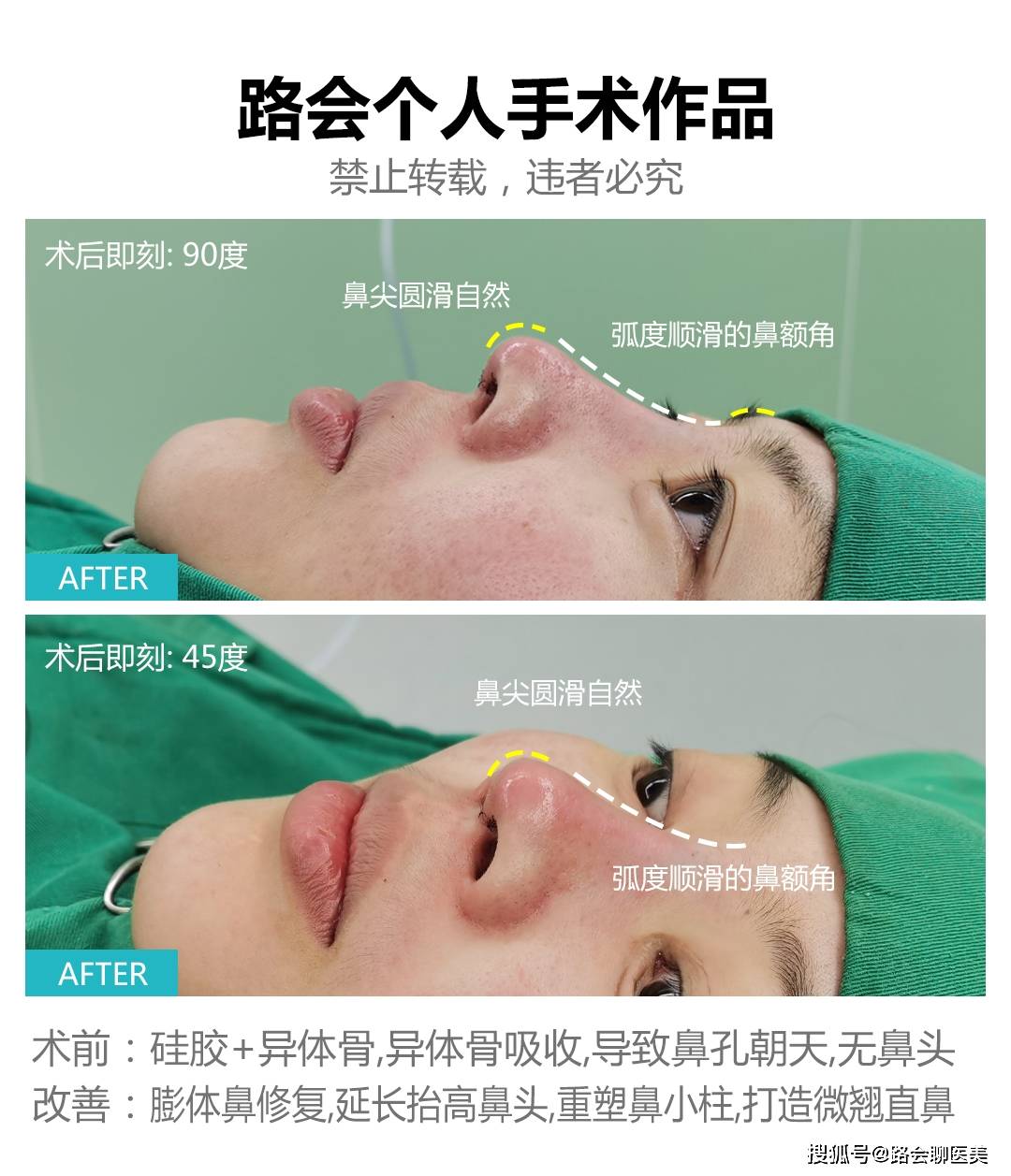 整形医生，你太搞笑了吧？做“妈生鼻子”不就是在做“寂寞”吗？
