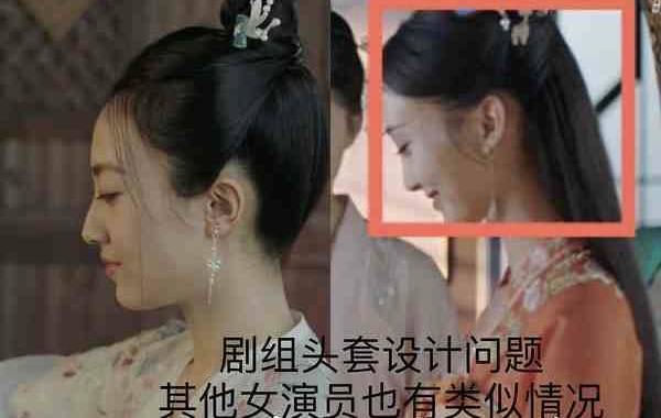 假发|她耳后斑秃？