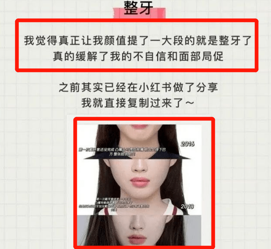 人造孙一宁半藏森林她用脑子整出了全网唯一的贵气千金脸