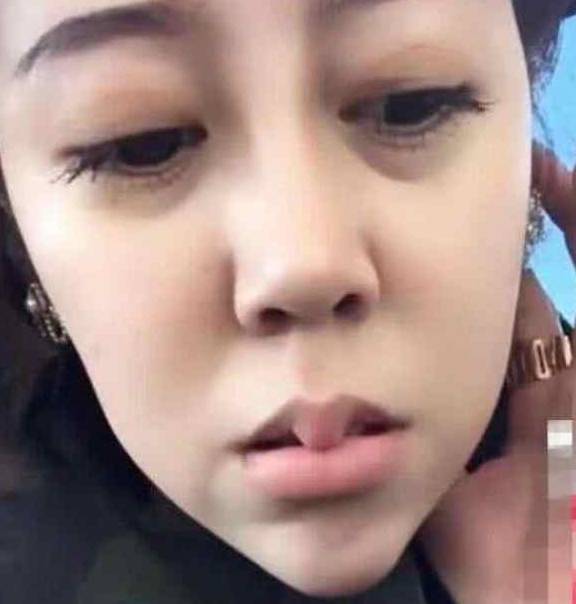因为抖音小姐姐唇珠奇大，想到了当年的嘟嘟姐，网友：好想薅下来！