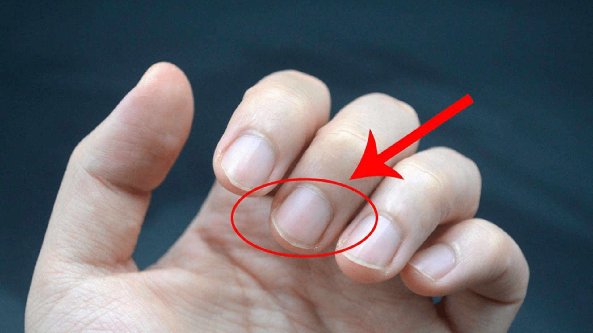 样子|手指长倒刺，该不该撕掉？男子因倒刺引出的悲剧