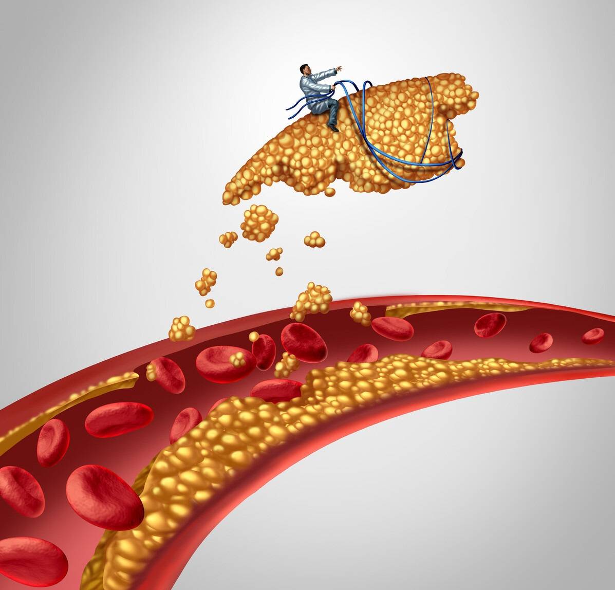 他汀|长期吃他汀，把肝吃伤了、肌肉溶解了，谁能负责？