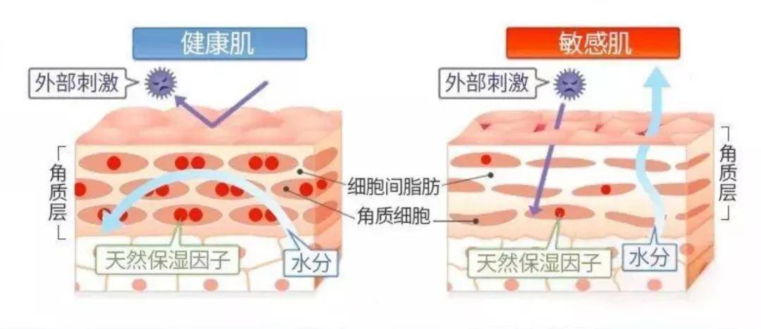 方法闭口，痘痘、敏感肌、暗沉，怎么破？