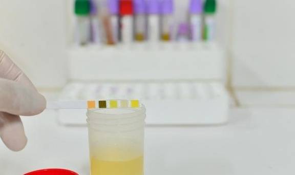 功能|排尿时发现这4个“蹊跷”,可能是肝发出的“通知”