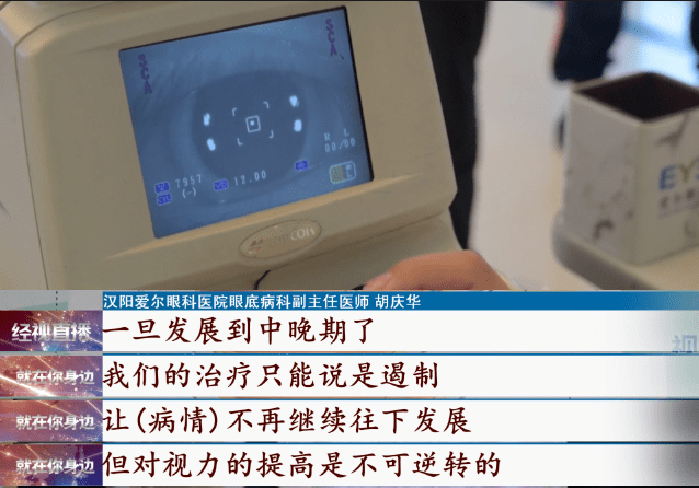 视网膜|女子遭遇“视力杀手”，一查发现是它引起病变