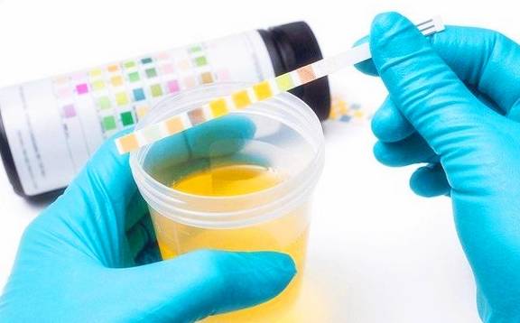 红细胞|身体如果出现这些异常的时候，最去做一个尿检，小心尿毒症找上门