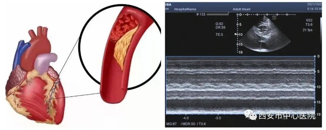 医学科|这帮彩超医师为了糖友，也是拼了！