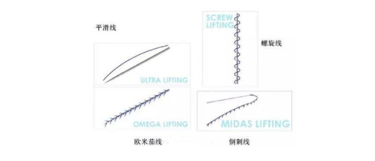 蛋白线雕恢复期真实图片告诉你线雕后脸上有凹陷多久能好？