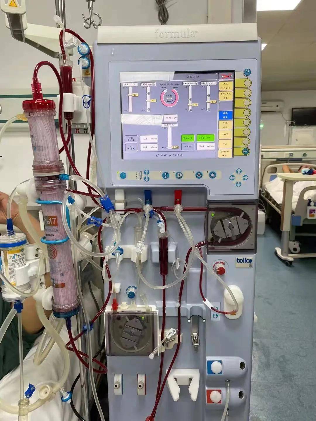 综合征|31岁小伙高烧不退以为是肠胃炎 竟是流行性出血热