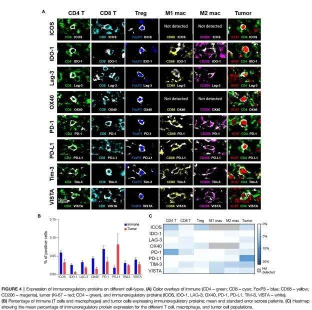 超多重免疫熒光技術推動腫瘤微環境精準研究
