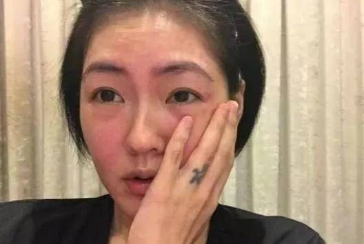 状态没了修图去掉美颜，女明星的痘痘、痘印也藏不住了！