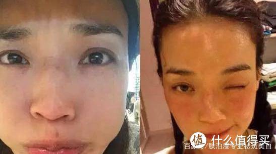 女神淡斑美白效果好的护肤品排行榜！这款淡斑效果永排第一！