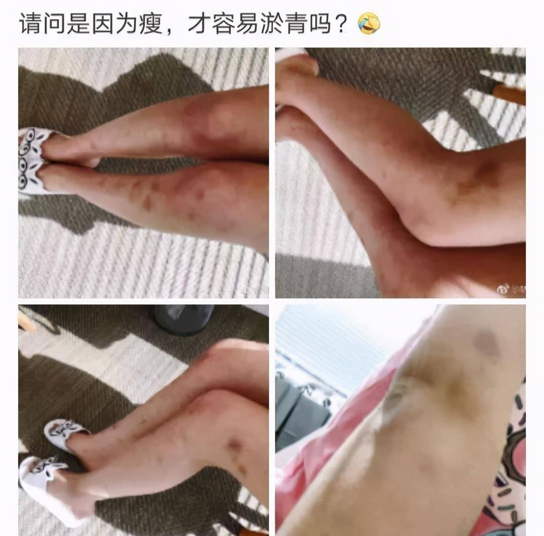 郭碧婷36岁郭碧婷近照流出，暴瘦脱相成路人，网友：还我女神