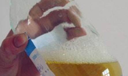 严重|为什么有的肾病发展到尿毒症才发现?可能忽视这个细节,不妨看看