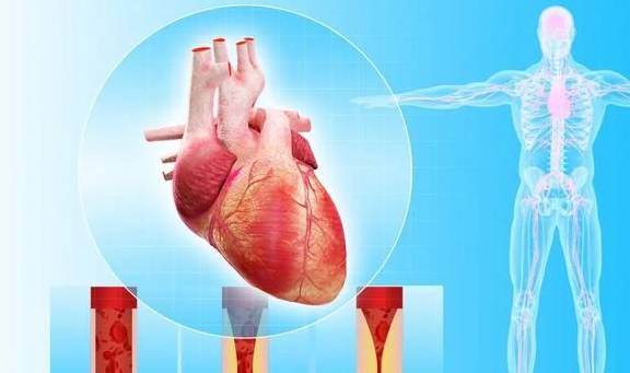 并发症|这个并发症会夺走多数糖尿病患者的生命！如何防治？