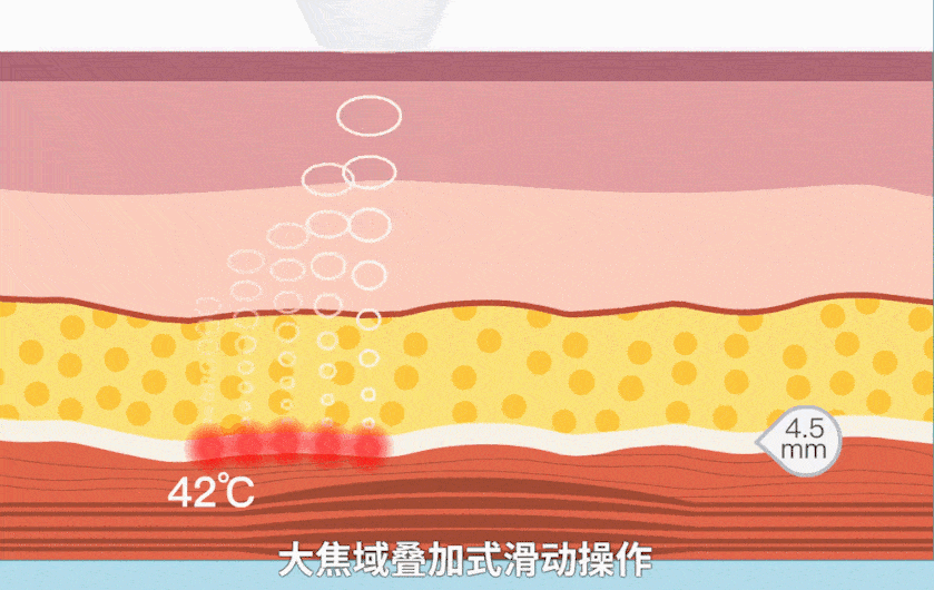 治疗医美圈疯狂内卷，谁才是抗衰王中王？