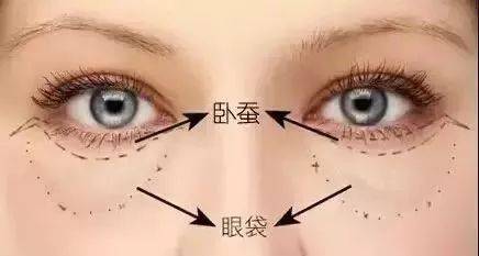 卧蚕和眼袋的对比图 e4d95aed6d1742039e2ac81034732e8d.jpeg