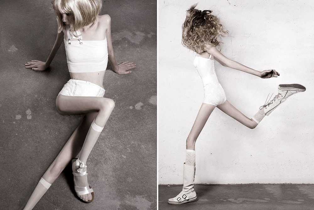 体型|宝宝越胖越可爱？肥胖的危害家长需警惕！