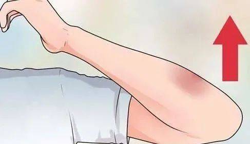 严重性|阿姨刚到家，电话响了：赶紧回医院！这种情况，要命！