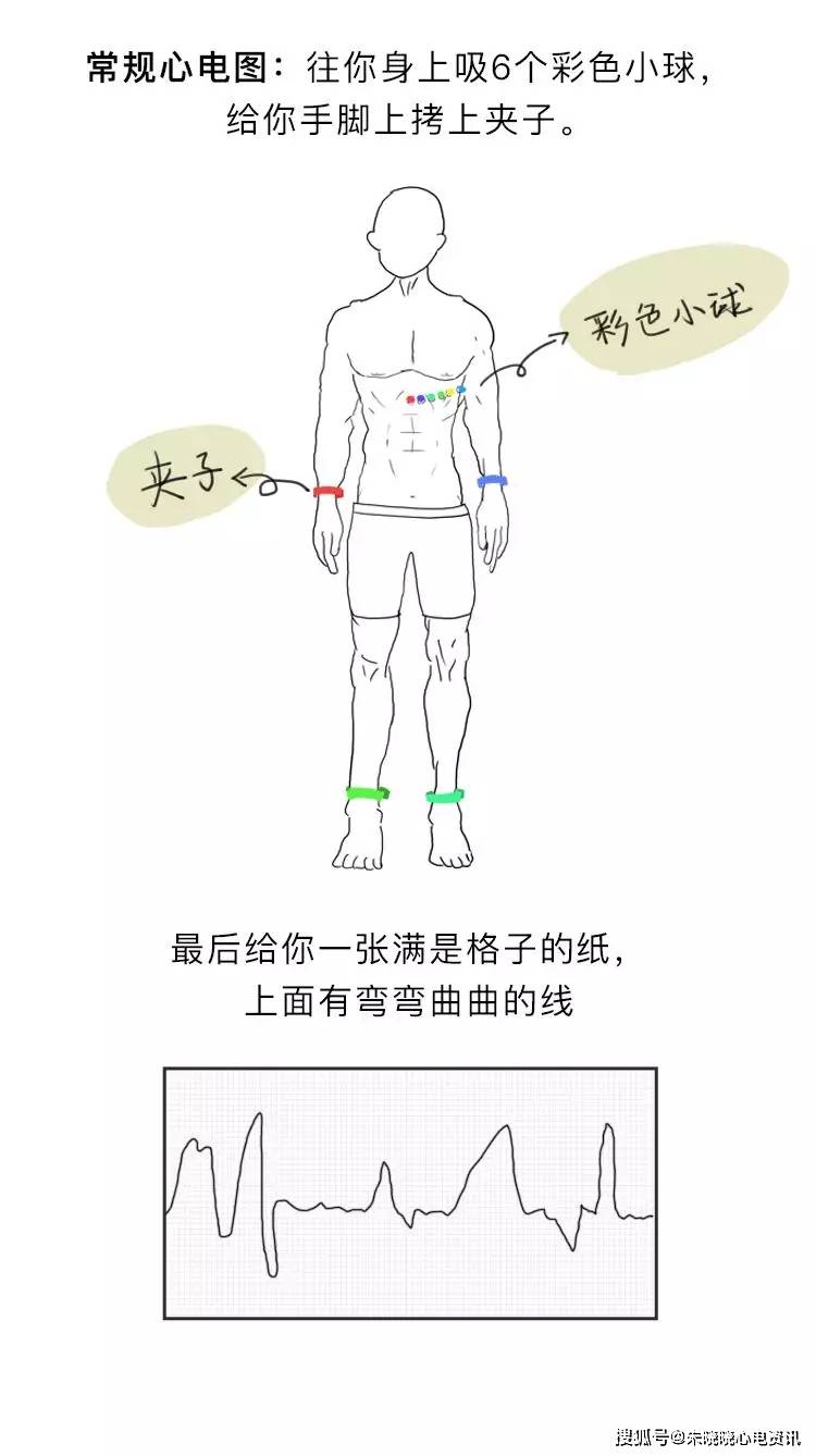 房颤|你了解房颤吗?一文图解掌握