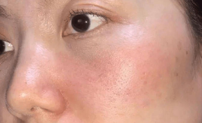 产品护肤时皮肤为什么会刺痛？主要是这3个原因“作怪”，不要忽视了