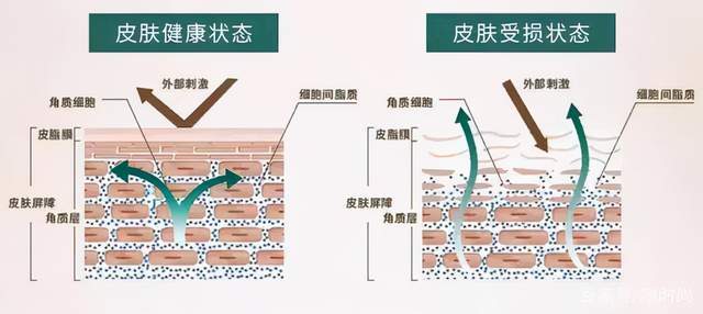 嘉玲嘉玲问题肌肤老师：冬季皮肤干燥怎么办
