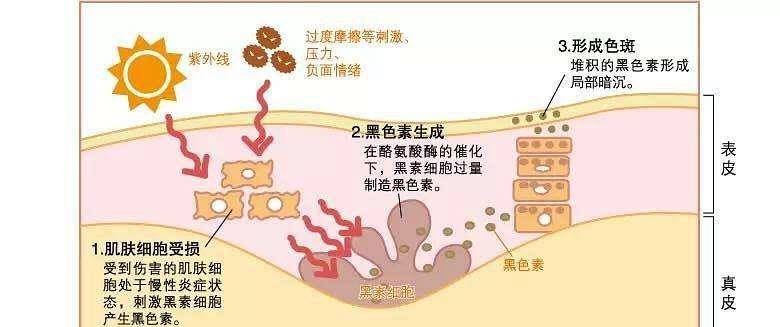 疗法不想变成黄脸婆？常吃3种食物，帮你美白祛斑