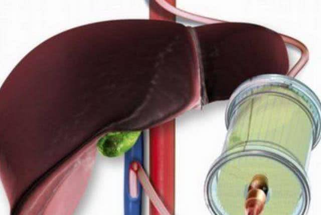 肝脏|肝不舒服的人,排毒降肝火!