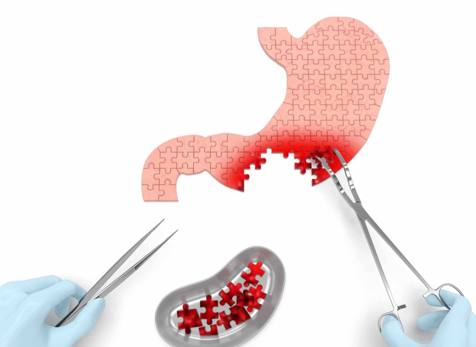 食品|8岁小孩50岁的胃，人未老胃先老！提醒：这4类食物不能吃