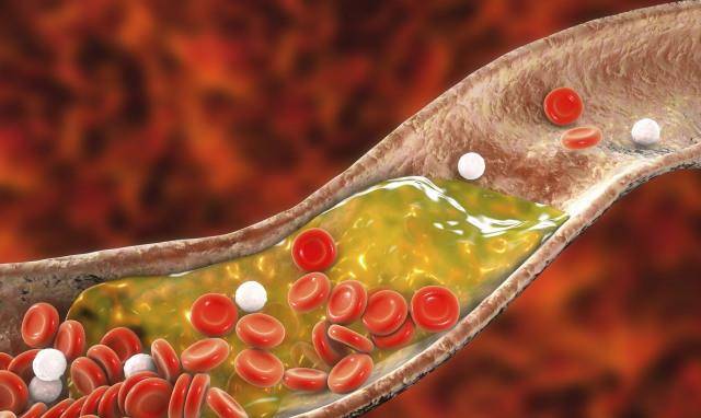 人体|6种“早餐”,聪明人也许从不碰,有些人却当宝,忍住就是赢