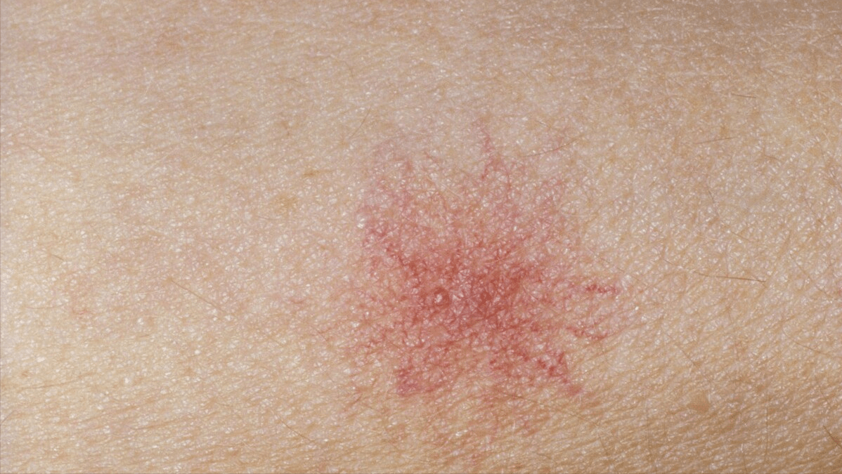 肝脏|肝脏损伤出现5点，常吃1物，好比护肝代谢肝脏的“解忧草”