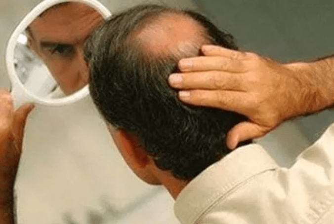 怎么护理头发不掉发 b873e0b48a454467a5c61fa233550189.png