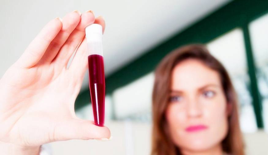 血液|体检中血液检验报告单重点应关注哪些项目？今天，来告诉各位答案