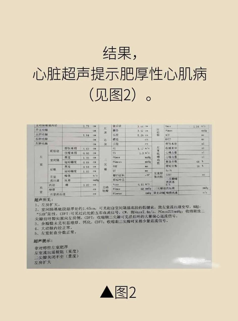 心肌缺血不一定是冠心病带你了解真相
