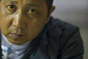 因为|爱酒者，若有“1黄、2臭”，可能是肝脏已受损，劝你早查肝CT